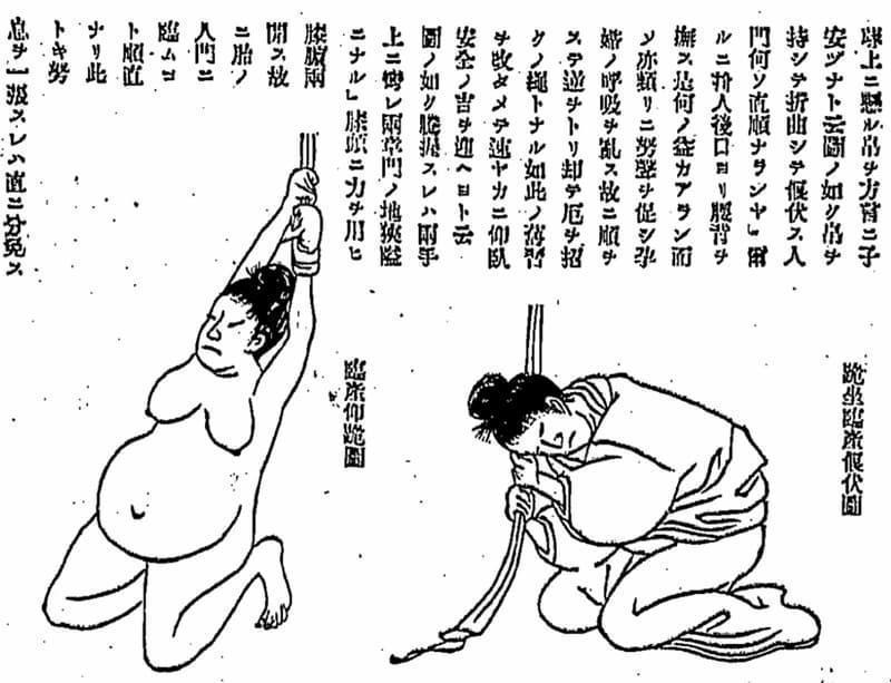 産綱(力綱)の様子(『日本産科叢書』より。出典:国立国会図書館デジタルコレクション)
